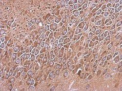 RP105/CD180 Antibody, Novus Biologicals 0.1mL; Unlabeled:Antibodies, Polyclonal