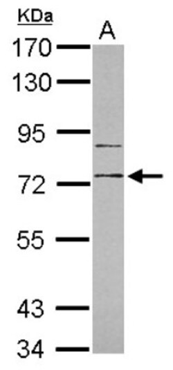 RP105/CD180 Antibody, Novus Biologicals 0.1mL; Unlabeled:Antibodies, Polyclonal