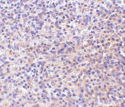 RP105/CD180 Antibody - BSA Free, Novus Biologicals 0.025 mg, Unconjugated:Antibodies,