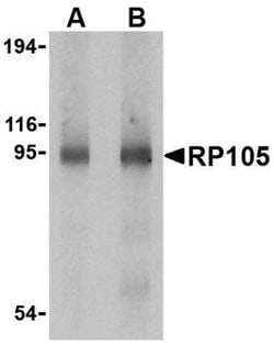 RP105/CD180 Antibody - BSA Free, Novus Biologicals 0.025 mg, Unconjugated:Antibodies,