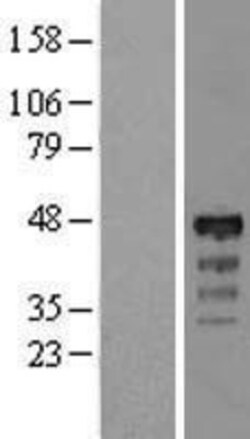 Novus Biologicals™ RP5-1077B9.4 Overexpression Lysate