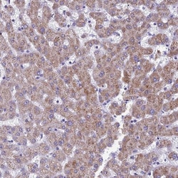 RP5-1077B9.4 Antibody, Novus Biologicals:Antibodies:Primary Antibodies