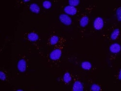 RPA2, p Ser4, p Ser8 Antibody, Novus Biologicals 0.1mL; Unlabeled:Antibodies,