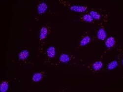 RPA2, p Ser4, p Ser8 Antibody, Novus Biologicals 0.1mL; Unlabeled:Antibodies,