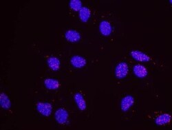 RPA2, p Ser4, p Ser8 Antibody, Novus Biologicals 0.1mL; Unlabeled:Antibodies,