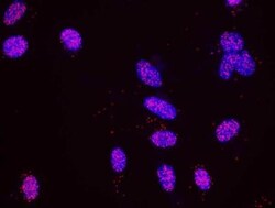 RPA2, p Ser4, p Ser8 Antibody, Novus Biologicals 0.1mL; Unlabeled:Antibodies,