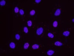 RPA2, p Ser4, p Ser8 Antibody, Novus Biologicals 0.1mL; Unlabeled:Antibodies,