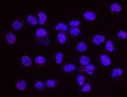 RPA2, p Ser4, p Ser8 Antibody, Novus Biologicals 0.1mL; Unlabeled:Antibodies,