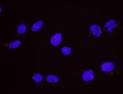 RPA2, p Ser4, p Ser8 Antibody, Novus Biologicals 0.1mL; Unlabeled:Antibodies,