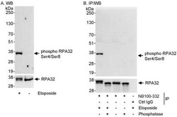 RPA2, p Ser4, p Ser8 Antibody, Novus Biologicals 0.1mL; Unlabeled:Antibodies,
