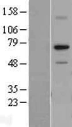 Novus Biologicals&trade;&nbsp;RPA70 Overexpression Lysate