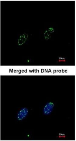 RPA70 Antibody, Novus Biologicals 0.1mL; Unlabeled:Antibodies