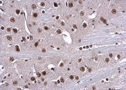 RPA70 Antibody, Novus Biologicals 0.1mL; Unlabeled:Antibodies