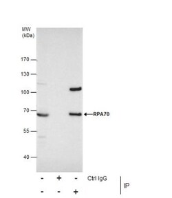RPA70 Antibody, Novus Biologicals 0.1mL; Unlabeled:Antibodies