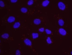 RPA70 Antibody, Novus Biologicals 0.1mg; Unlabeled:Antibodies, Polyclonal