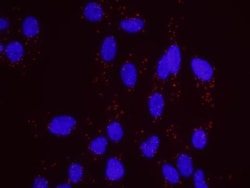 RPA70 Antibody, Novus Biologicals 0.1mg; Unlabeled:Antibodies, Polyclonal