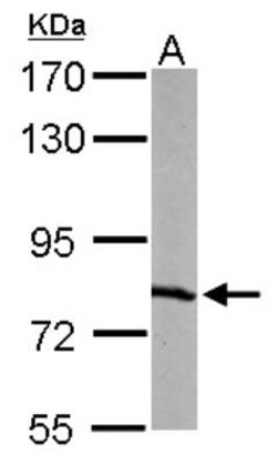 RPA70 Antibody, Novus Biologicals 0.1mL; Unlabeled:Antibodies