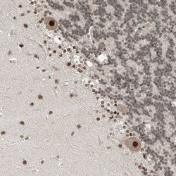 RPAIN Antibody, Novus Biologicals 25 &mu;L; Unlabeled:Antibodies, Polyclonal