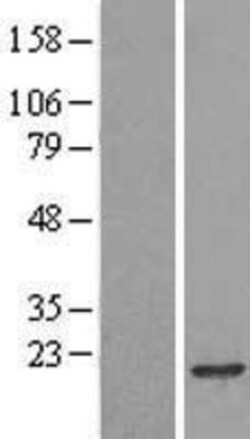 Novus Biologicals&trade;&nbsp;RPB8 Overexpression Lysate