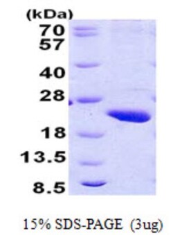Novus Biologicals&trade;&nbsp;Recombinant Human RPB8 His Protein