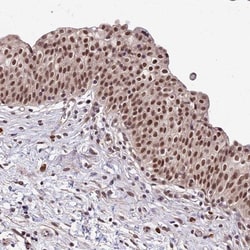 RPB9 Antibody, Novus Biologicals 25 &mu;L, Unconjugated:Antibodies, Polyclonal