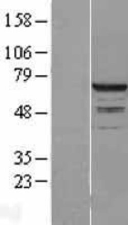 Novus Biologicals&trade;&nbsp;RPC62 Overexpression Lysate