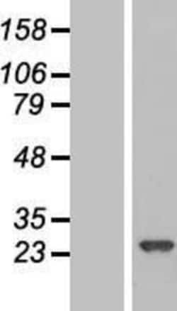Novus Biologicals&trade;&nbsp;RPE Overexpression Lysate