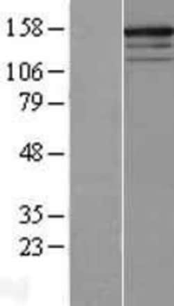Novus Biologicals™ RPGRIP1 Overexpression Lysate