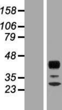 Novus Biologicals&trade;&nbsp;RPH3AL Overexpression Lysate