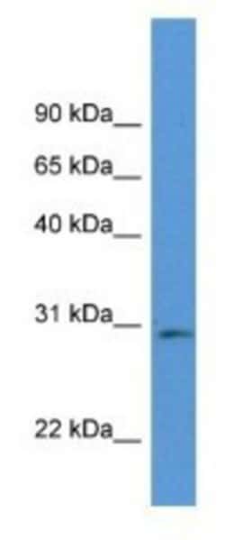 RPIA Antibody, Novus Biologicals 100&mu;L; Unlabeled:Antibodies, Polyclonal