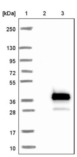 DGK-gamma Antibody, Novus Biologicals:Antibodies:Primary Antibodies