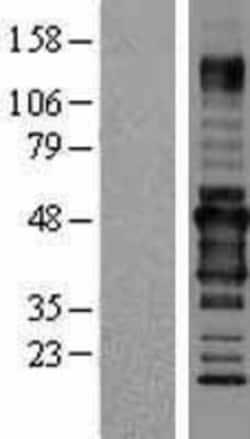 Novus Biologicals&trade;&nbsp;RPIP8 Overexpression Lysate