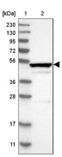 RPIP8 Antibody, Novus Biologicals 25 &mu;L; Unlabeled:Antibodies, Polyclonal