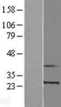 Novus Biologicals&trade;&nbsp;RPL10 Overexpression Lysate