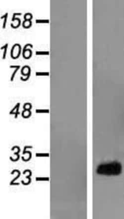 Novus Biologicals&trade;&nbsp;RPL10A Overexpression Lysate