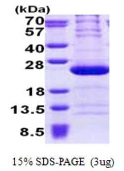 Novus Biologicals&trade;&nbsp;Recombinant Human RPL11 His Protein