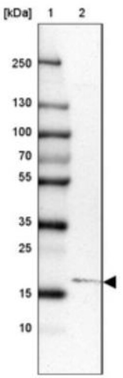RPL11 Antibody, Novus Biologicals 0.1mL; Unlabeled:Antibodies, Polyclonal