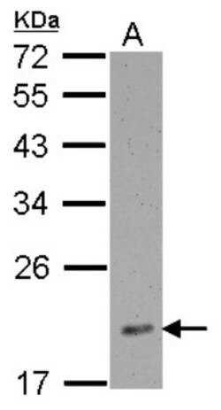RPL12 Antibody, Novus Biologicals 0.1mL; Unlabeled:Antibodies, Polyclonal