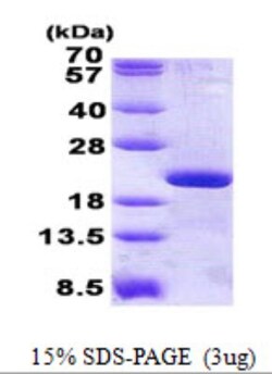 Novus Biologicals&trade;&nbsp;Recombinant Human RPL12 His Protein