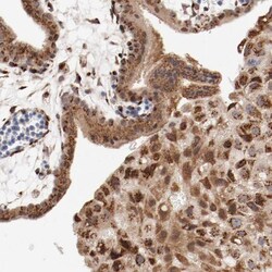 RPL12 Antibody, Novus Biologicals 0.1mL; Unlabeled:Antibodies, Polyclonal
