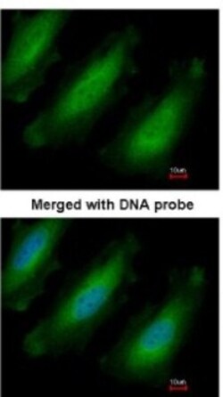 RPL13A Antibody, Novus Biologicals 0.1mL; Unlabeled:Antibodies, Polyclonal