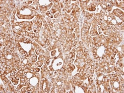 RPL13A Antibody, Novus Biologicals 0.1mL; Unlabeled:Antibodies, Polyclonal