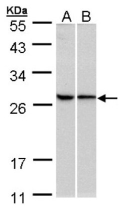 RPL13A Antibody, Novus Biologicals 0.1mL; Unlabeled:Antibodies, Polyclonal