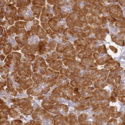 RPL13A Antibody, Novus Biologicals 0.1mL; Unlabeled:Antibodies, Polyclonal