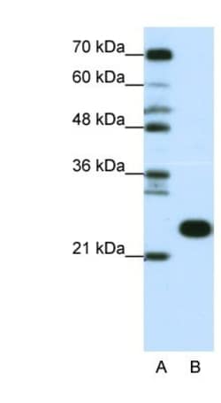 RPL13 Antibody, Novus Biologicals 0.05mg; Unlabeled:Antibodies, Polyclonal