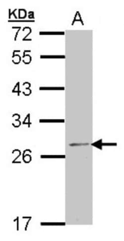 RPL14 Antibody, Novus Biologicals 0.1mL; Unlabeled:Antibodies, Polyclonal