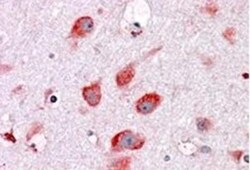 RPL22 Antibody, Novus Biologicals 0.1mg; Unlabeled:Antibodies, Polyclonal