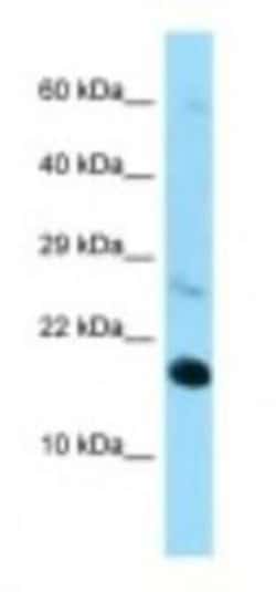 RPL22 Antibody, Novus Biologicals 100&mu;L; Unlabeled:Antibodies, Polyclonal