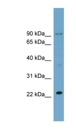 RPL24/RLP24 Antibody, Novus Biologicals 100&mu;L; Unlabeled:Antibodies,