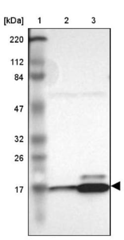 RPL27 Antibody, Novus Biologicals 0.1mL; Unlabeled:Antibodies, Polyclonal